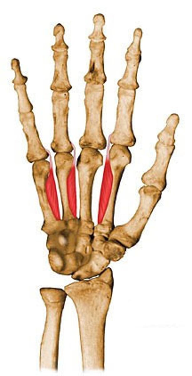 <p>Origin: Palmar surfaces of metacarpals 2, 4, and 5.</p><p>Insertion: Extensor expansions and bases of proximal phalanges of digits 2, 4, and 5.</p><p>Innervation: Ulnar nerve.</p><p>Action: Adduction of index, ring, and little fingers; MP flexion; DIP and PIP extension.</p>