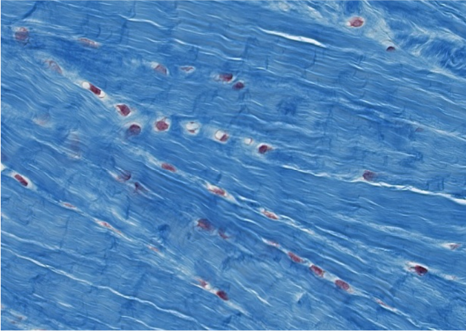 <p><span style="font-family: "Calibri Light";">Which type of CT is this?</span></p>