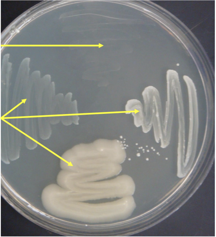 <p>bottom lines is what?</p>