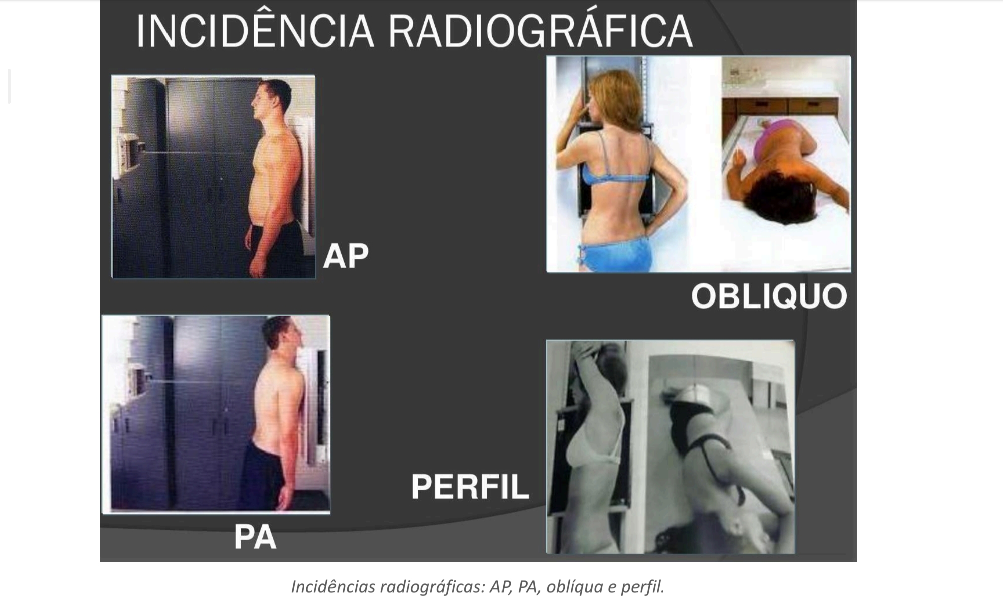 <p>Qual a diferença entre incidência AP e PA?</p>