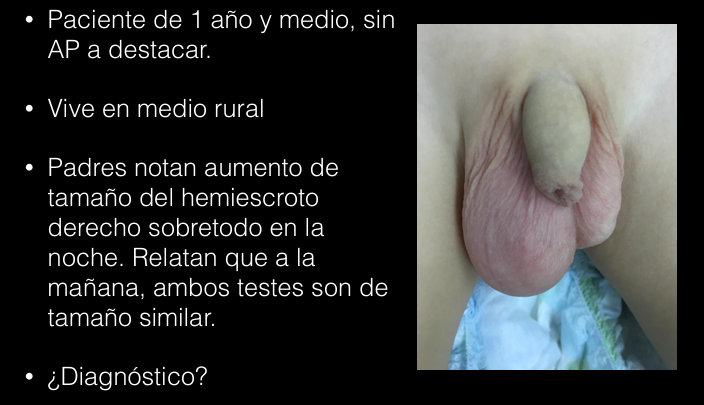 <p>Caso 2</p>