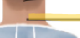<p>What term is this?</p>