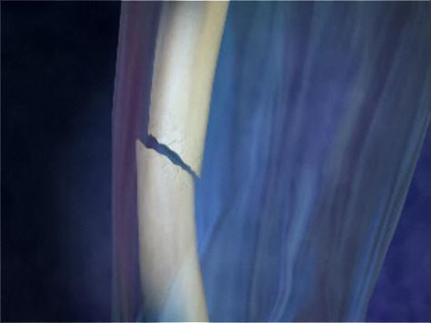 <p>skin did not break</p>