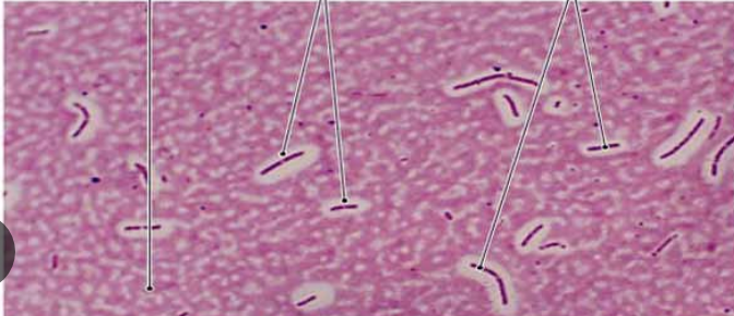 <p>What kind of stain is this ?</p>