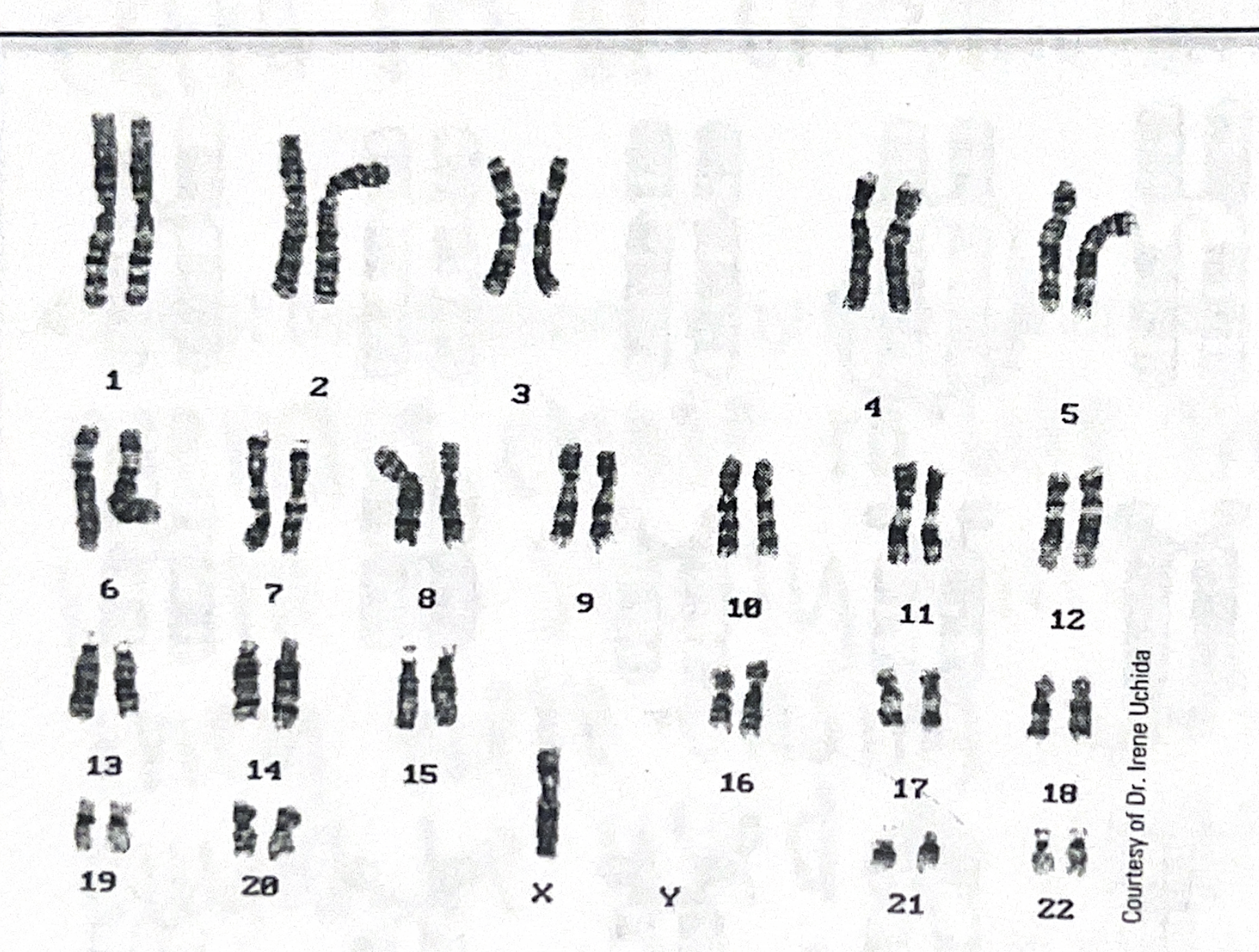 <p>examine the karyotype</p>
