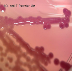 <ul><li><p>groei op alle algemene bodems </p></li><li><p>groei op MC met roze slijmerige kolonies (lactosepositief) </p></li><li><p>facultatief aeroob</p></li></ul><p></p>