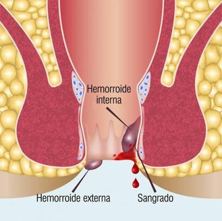 <p>Formaciones vasculares y estructuras anatómicas normales del cuerpo humano.</p>