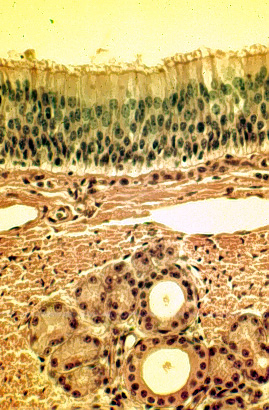 <p>Pseudo-stratified Ciliated Columnar</p>