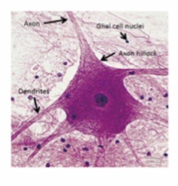 <p>Motor Neuron </p>