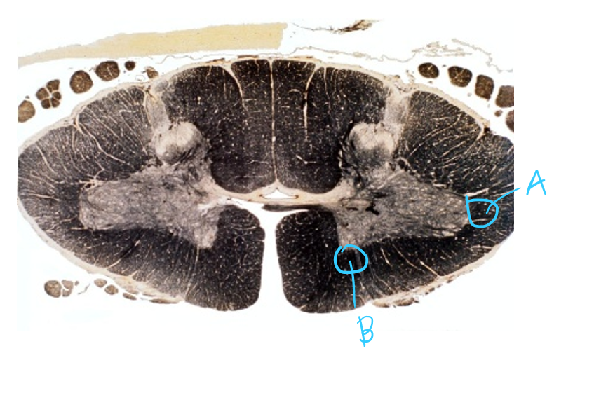 <p>Consider A and B. Describe the path of the neurons and the functions.</p>