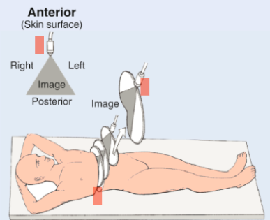 <p>Laying on back</p><p>Indicator towards machine (patient’s right)</p>