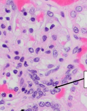 <p>what is arrow pointing to (glomerulus)</p>