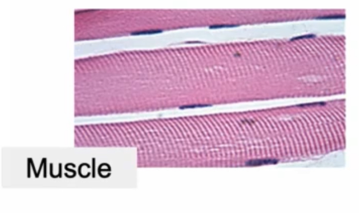 <p>Composed of bunch of stripes (mostly) with scattered cells (identifiable by the scattered nuclei dark dots)</p>