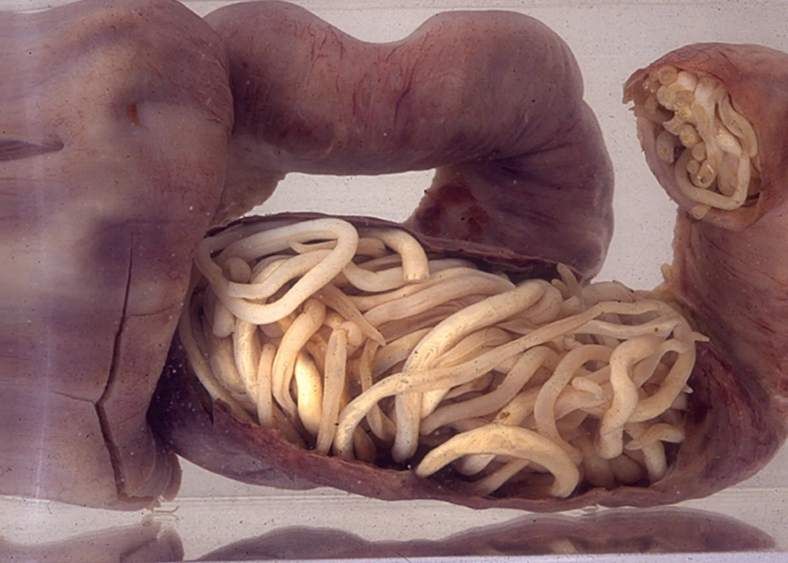 <p>A parasite that lives inside the body of a host, such as <strong>tapeworms or roundworms</strong>, deriving nutrients from the host's internal environment - their blood, muscle, and intestinal tract</p>