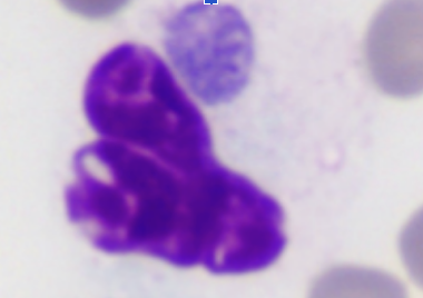 <p>(Top middle spot)</p>