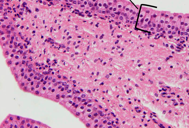 <p>welke weefsels</p>