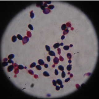 <p>Rhodotorula rubra</p>