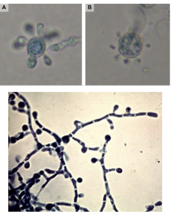 <p>-Yeast-like, round “mariner’s wheel” with circumferential meeting</p><p>-Mold: septate, yaline,terminal and intercalary chlamydospores</p><p>-Mold: sepate, hyaline, terminal and intercalary chlamydospores</p><p>-Don’t mix up with H. capsulatum’s mold </p>