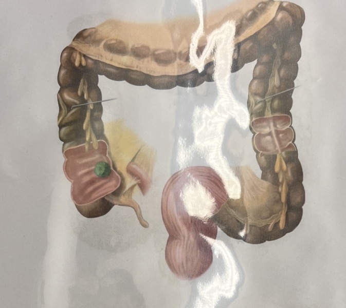 term image