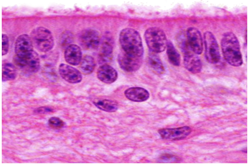 <p>type of glial cell in the central nervous system </p>