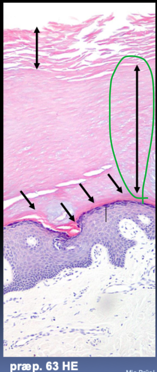 <p>Tætte keratinbundter + stærk cornified envelope.</p>
