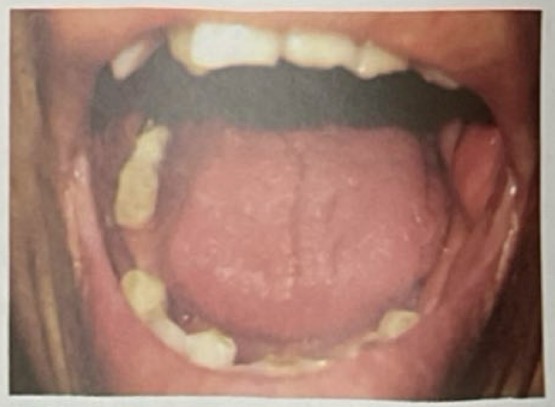 <p>CHẨN ĐOÁN?</p>