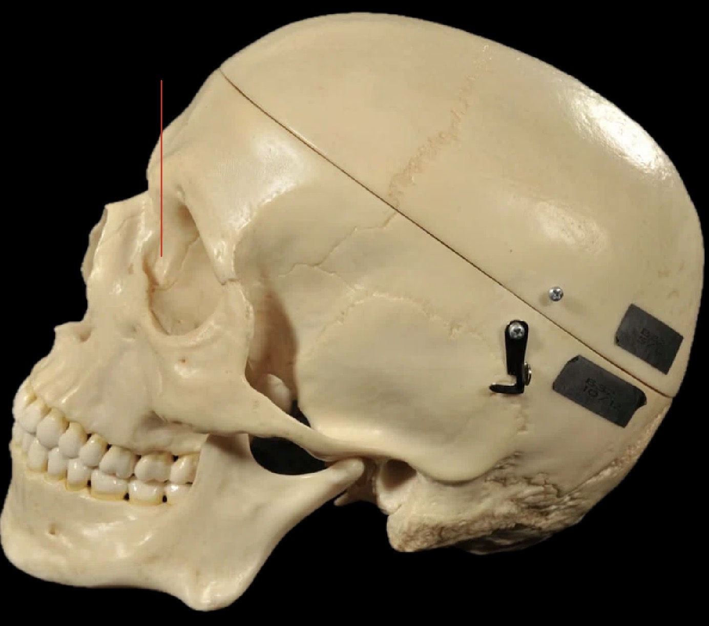 <p>What bones are these?</p>