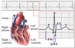 <p>✓ P-vilnis</p><p>✓ PQ-segments</p><p>✓ PQ-intervāls</p><p>✓ QRS-komplekss</p><p>✓ ST-segments</p><p>✓ T-vilnis</p><p>✓ U-vilnis</p><p>✓ QT-intervāls</p>