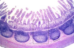 <p>Peyer's patches</p>