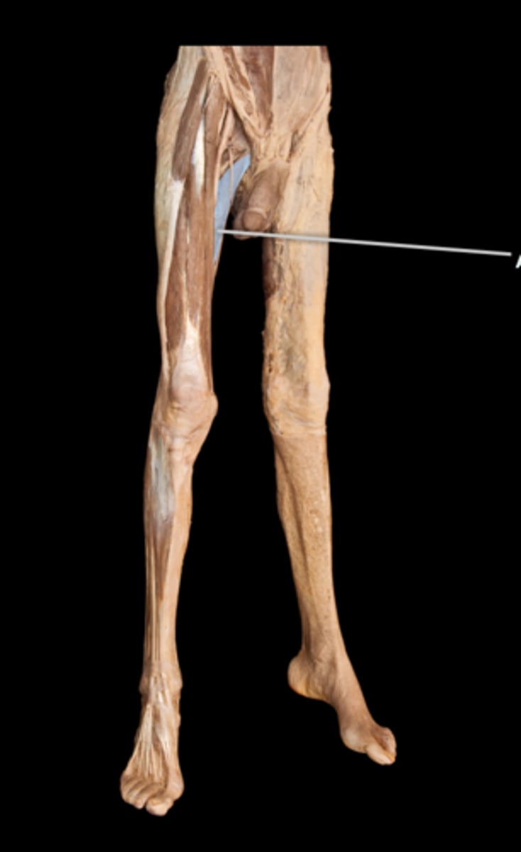 <p>What muscle is this?</p>