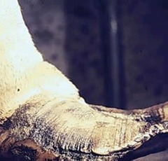 <p>Rumen acidosis</p>