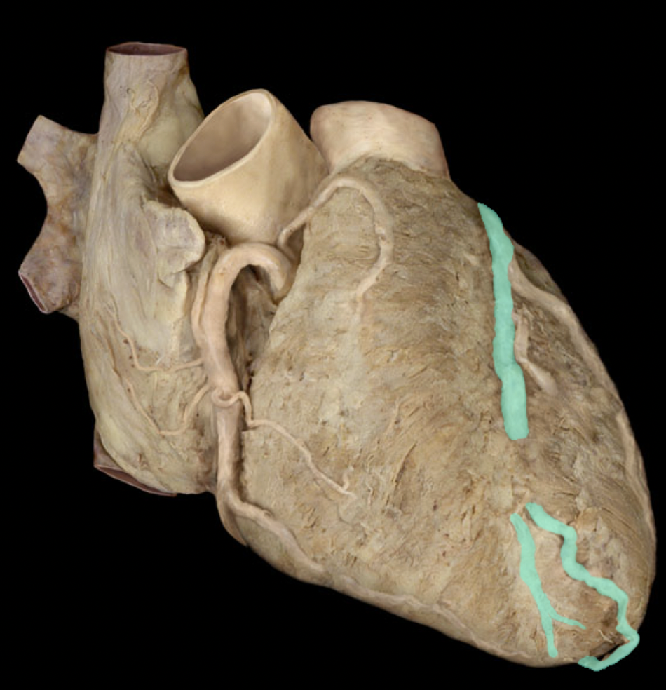 <p>Identify the feature of the left coronary artery</p>