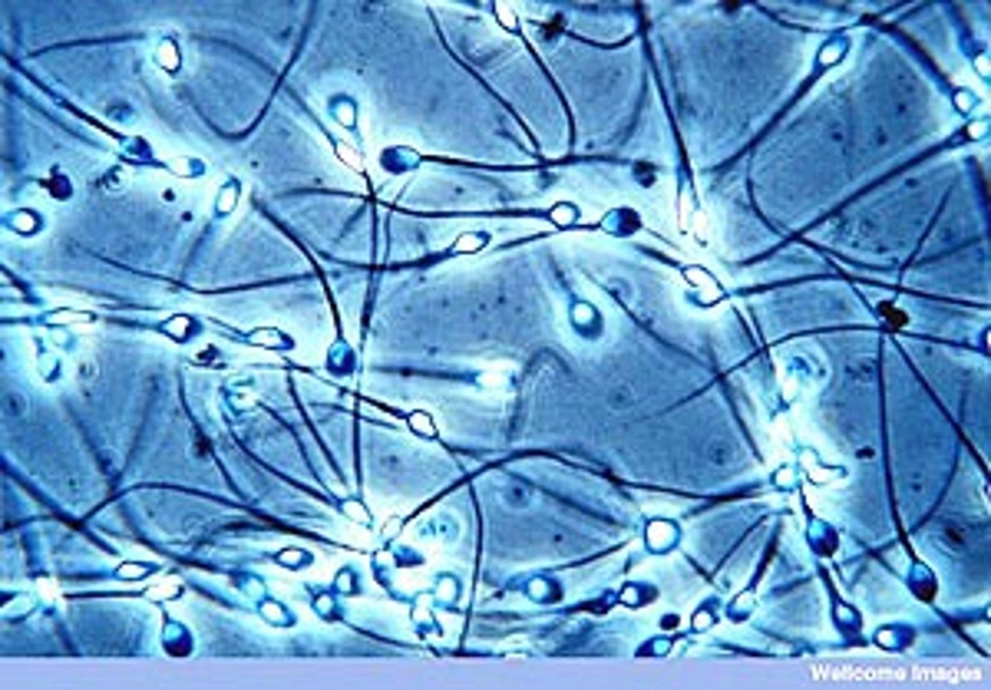 <p>Male gamete that delivers paternal DNA to the oocyte.</p>