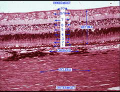 <p>Identify the layer of the retina (4)</p>