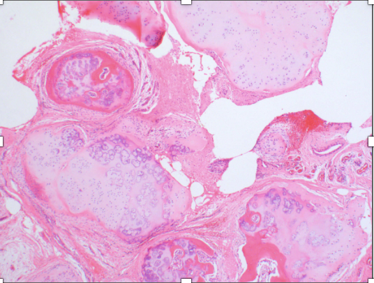 <p>multiples nodules genou homme de 30 ans </p><p>diagnostic</p><p>définition</p><p>age</p><p>topographie</p><p>anatomie</p><p>histologie</p><p>moléculaire</p>
