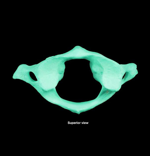 <p>What part of the cervical vertebrae is this?</p>