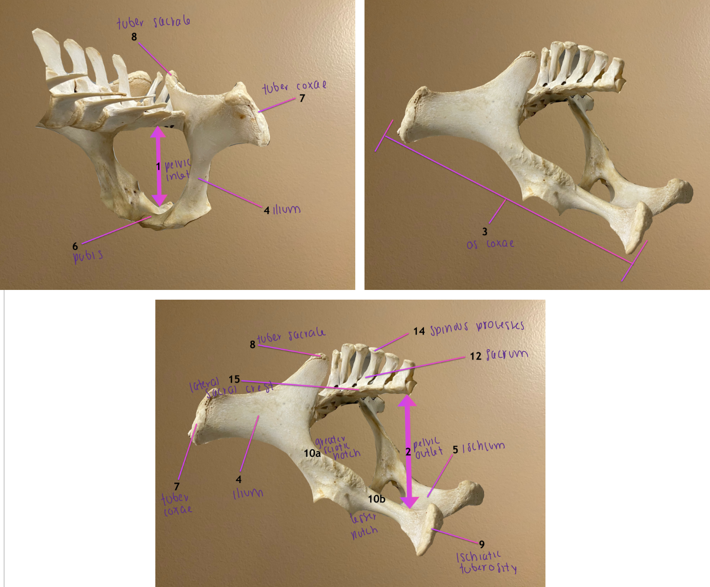 <ol start="5"><li><p>ischium</p></li><li><p>pubis</p></li><li><p>tuber coxae</p></li><li><p>tuber sacrale</p></li></ol><p></p>