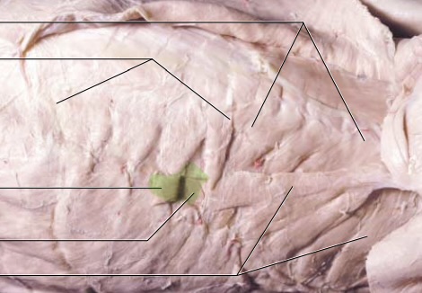 <p>(Between ribs)</p>