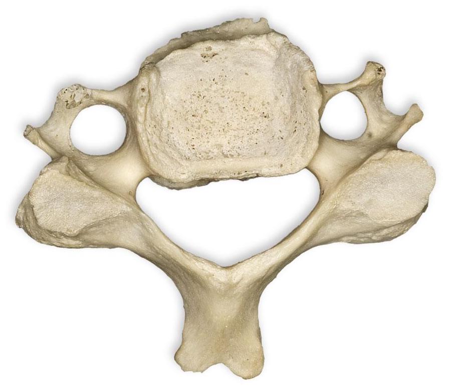 <p>What vertebrae? Identify 2 key processes</p>