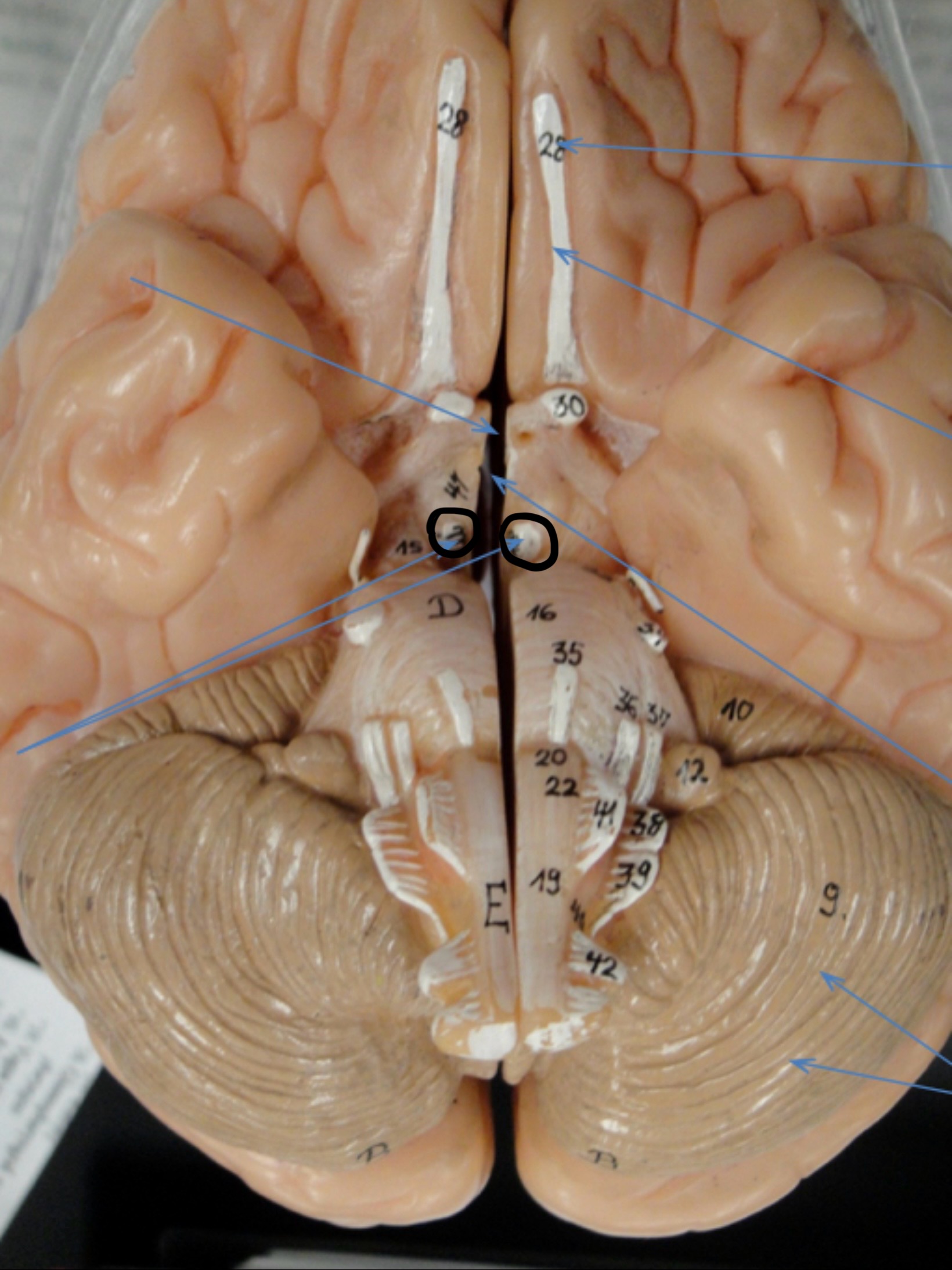 <p>Identify the circled area?</p>