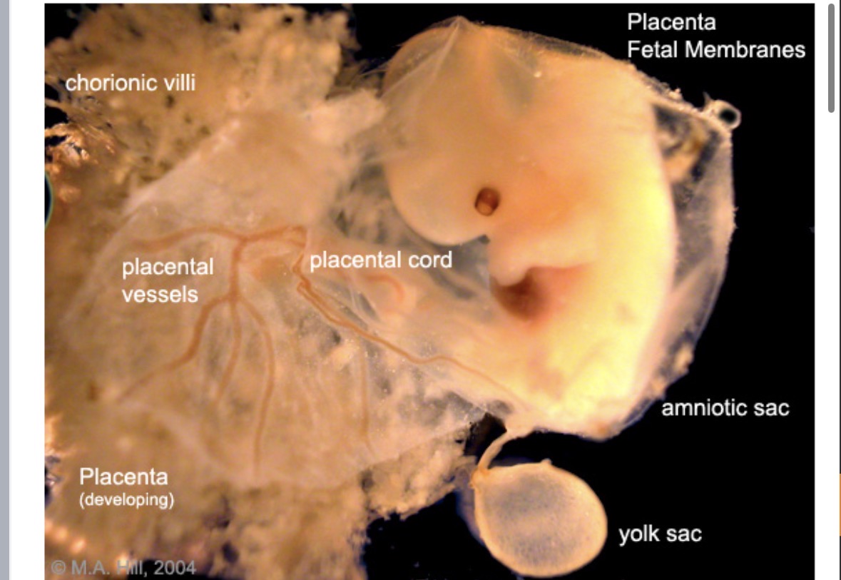 <p><strong>temporary</strong> organ</p><p><strong>connects</strong> developing fetus to <strong>uterine wall</strong></p><p>responsible for <strong>nutrient</strong> uptake, <strong>waste</strong> elimination, and <strong>gas</strong> exchange via mother’s blood supply</p><p><strong>connects</strong> to fetus via <strong>umbilical cord</strong></p>