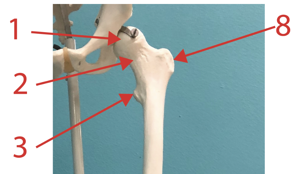 <p>What is #1?</p>