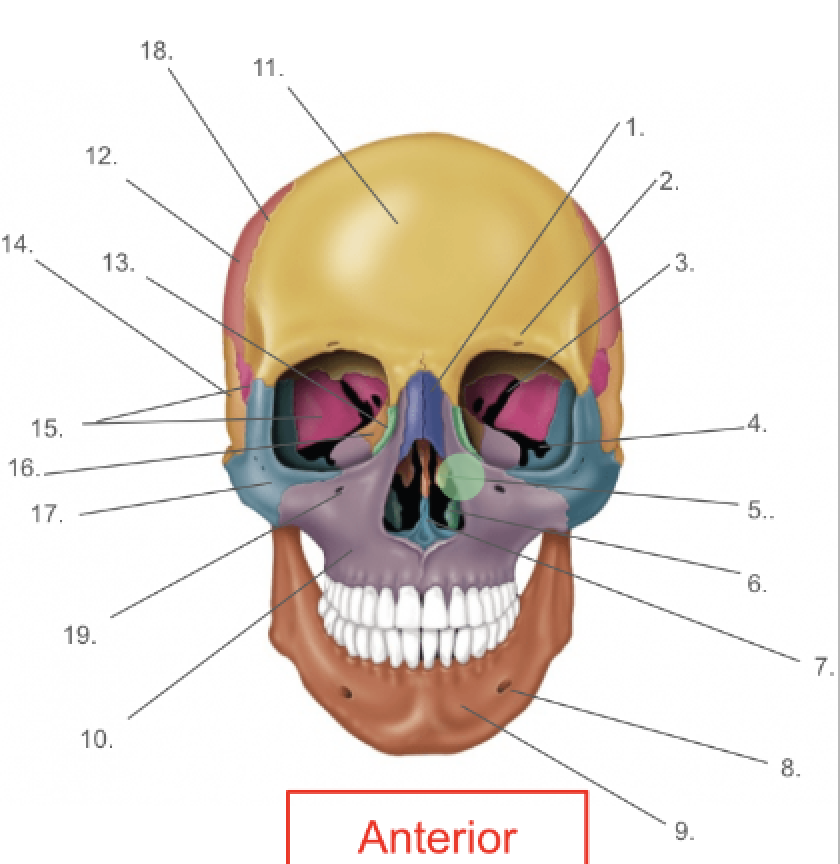 term image