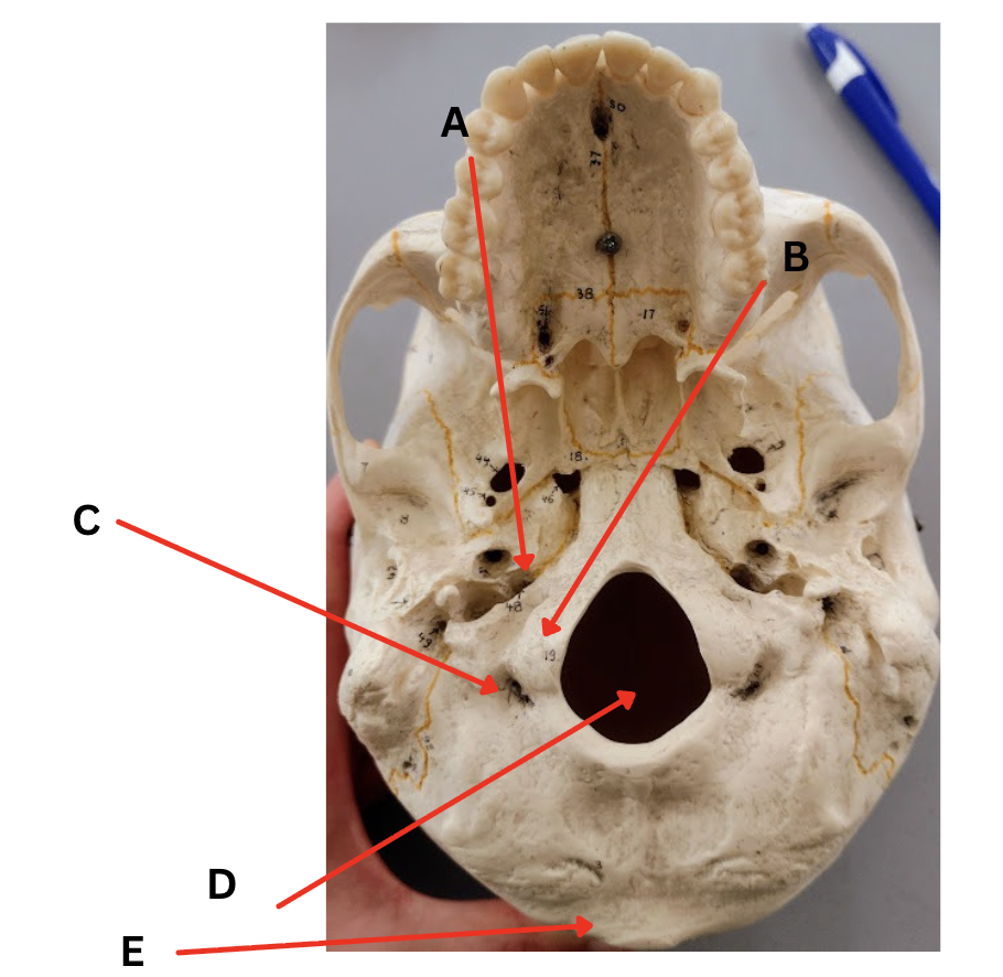 <p>Identify Marking D</p>