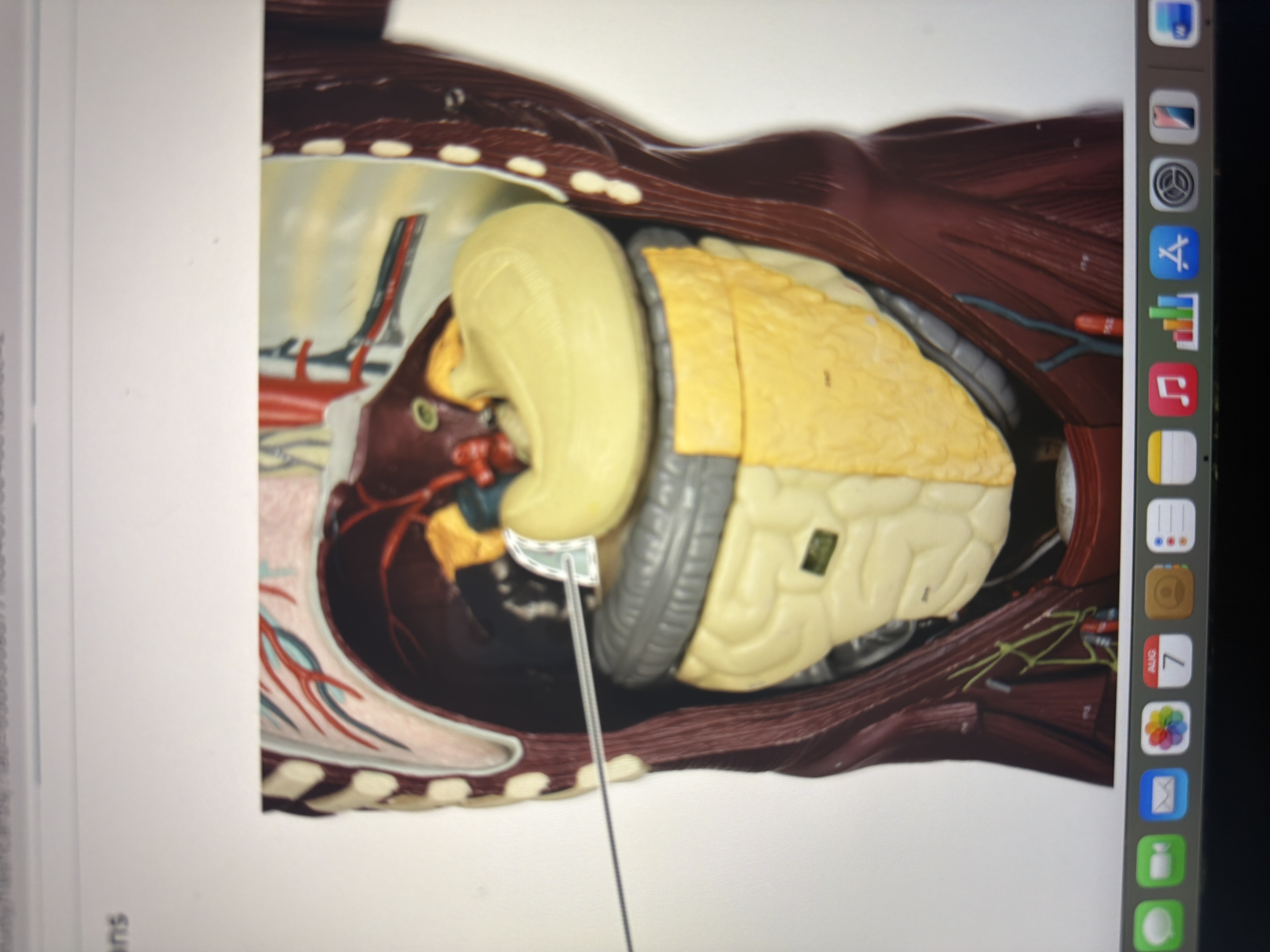term image