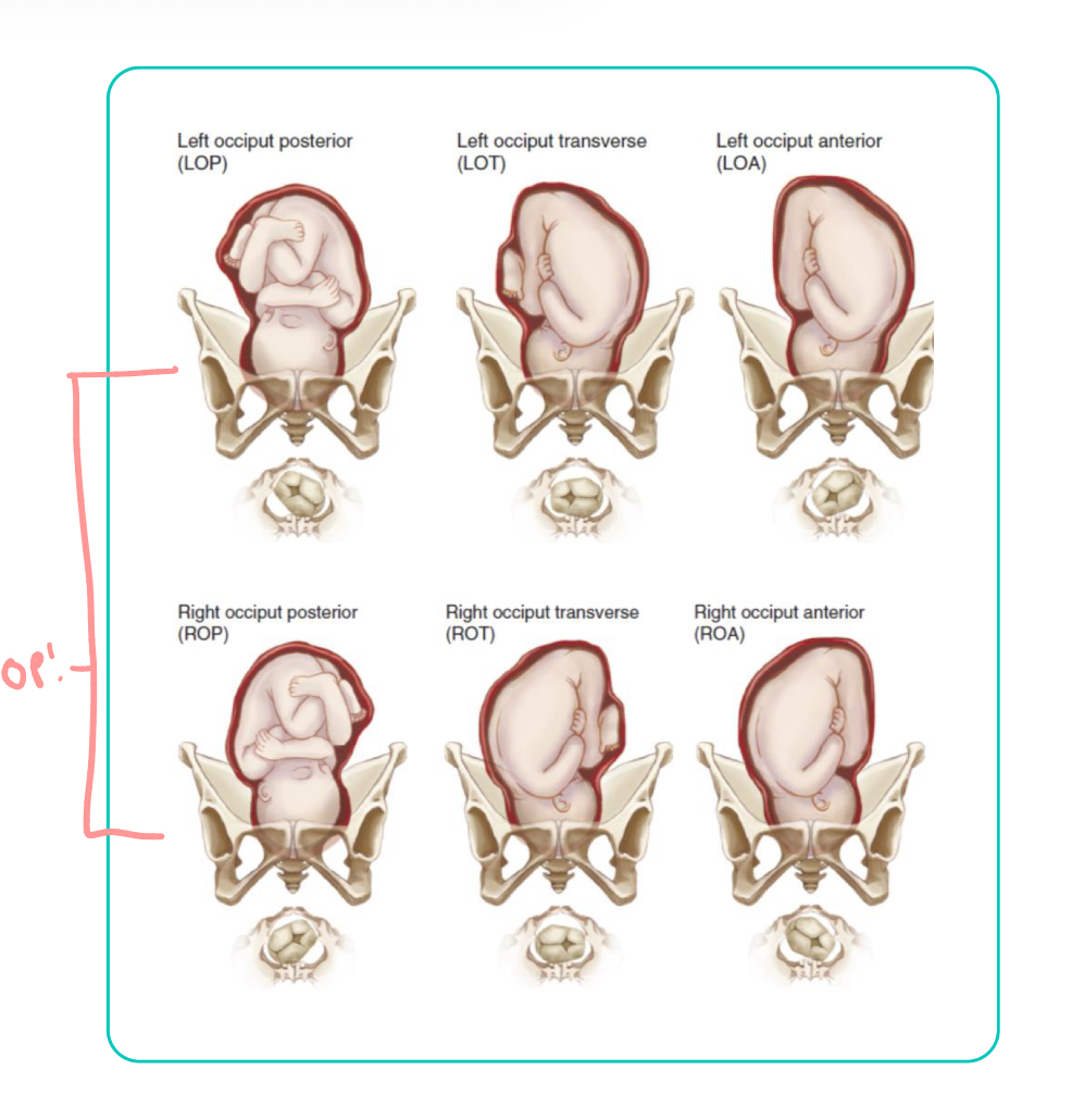 <ul><li><p>all longitudinal lie w/ flexion attitude </p></li></ul><p></p>