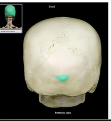 <p>Bump in the back of the head on occipital bone</p>