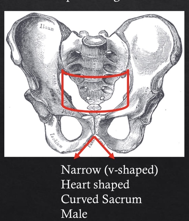 <ul><li><p><strong><u>Male</u></strong></p><ul><li><p><u>Size</u>: large and rugged</p></li><li><p><u>Ilium</u>: high and vertical</p></li><li><p><u>Pelvic Inlet</u>: heart shaped</p></li><li><p><u>Subpubic</u> Angle: V-shaped</p></li><li><p><u>Pubic Shape</u>: narrow and rectangular</p></li><li><p><u>Greater Sciactic Notch</u>: narrow</p></li><li><p><u>Pre auricular sulcu</u>s: rare</p></li><li><p><u>Shape of Sacrum</u>: long and narrow</p></li><li><p><u>Obturador foramen</u>: large and oval</p></li></ul></li></ul><p></p>