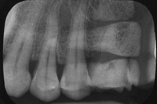 <p>Double Exposure</p>