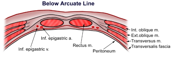 <ul><li><p>Inf. epigastric v.</p></li><li><p>Inf. epigastric a.</p></li><li><p>Rectus m.</p></li><li><p>Peritoneum</p></li><li><p>Int. oblique m.</p></li><li><p>Ext. oblique m.</p></li><li><p>Transversus m.</p></li><li><p>Transversalis fascia</p></li></ul><p></p>